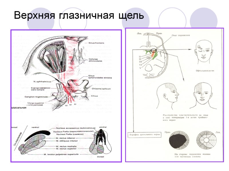 Верхняя глазничная щель